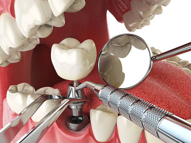 Best Emergency Broken Tooth Repair in Sixteen Mile Stand, OH